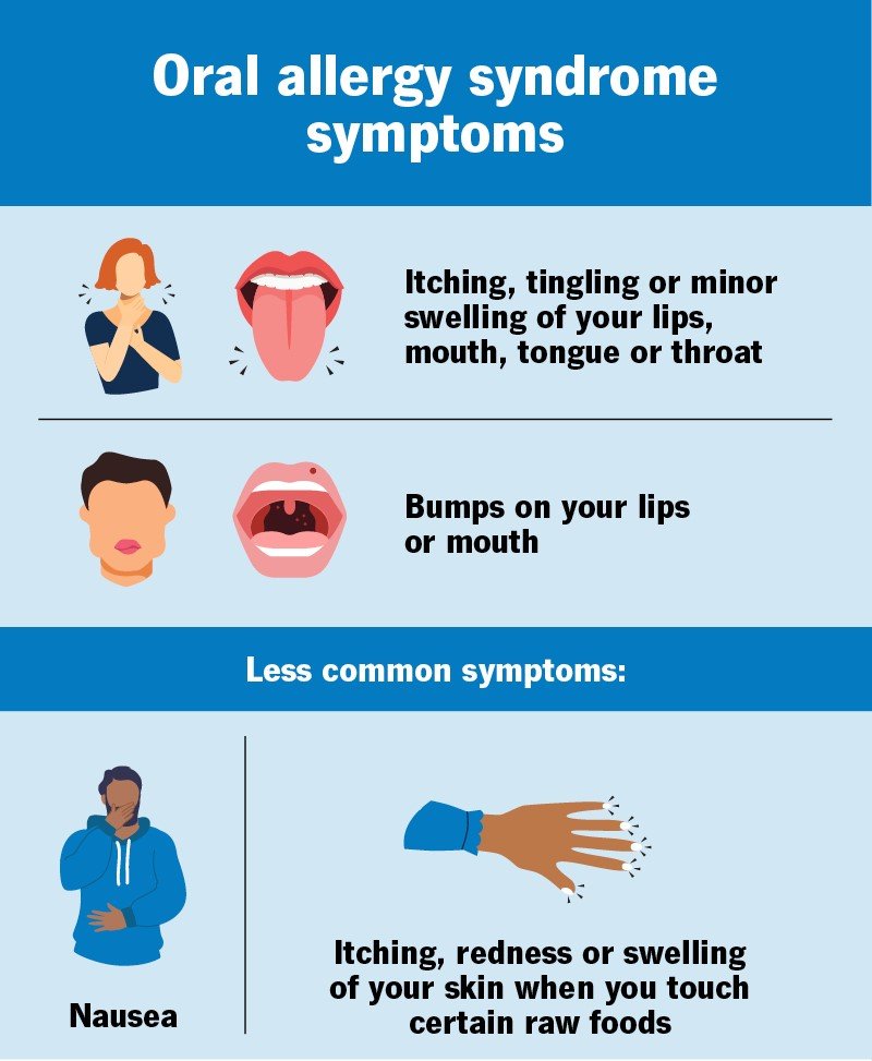 Oral Allergy Syndrome Symptoms: Signs, Causes, and Triggers